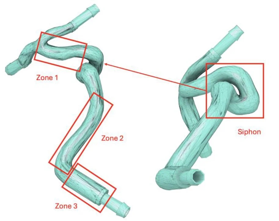 Decomposition of carotid zones